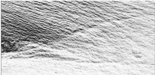 Skin Booster Treatment Results After