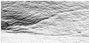 Skin Booster Treatment Results Before